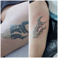 tetovanie-04.png